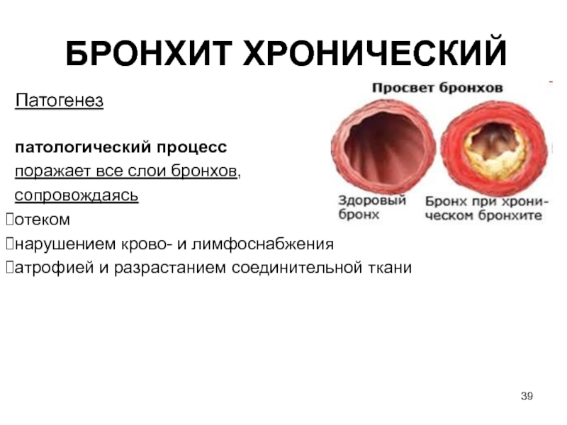Инфекционный бронхит кур: симптомы, диагностика болезни, лечение, профилактика